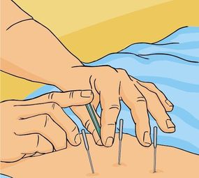 Studio de Acupuntura e Bem-estar photo 1